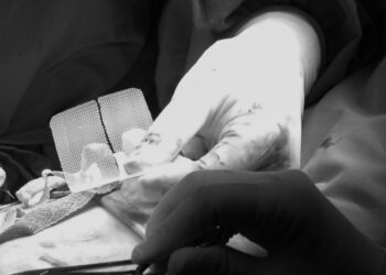 Pooperacinė išvarža: kas tai, simptomai ir gydymas