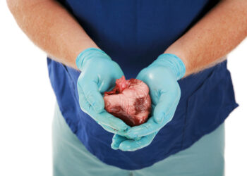 Hipoplastinės kairiosios širdies sindromas: priežastys, simptomai ir gydymas