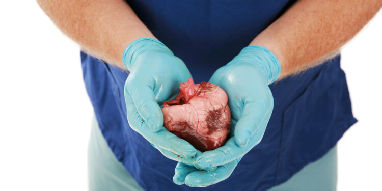 Hipoplastinės kairiosios širdies sindromas: priežastys, simptomai ir gydymas