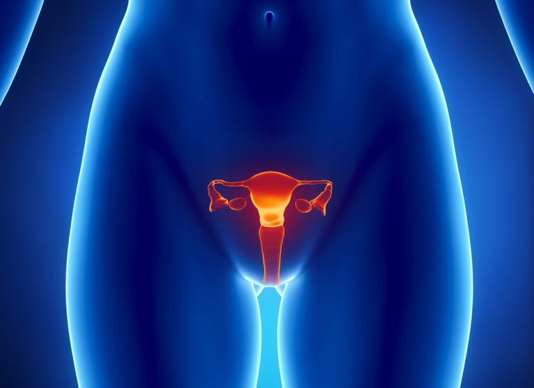 Hidrosalpinksas: priežastys, simptomai, diagnostika ir gydymas