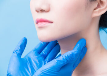 Hipotirozės gydymo galimybės