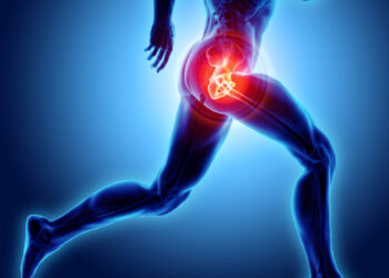 Kada čiurnos sąnario keitimas nėra tinkama procedūra?