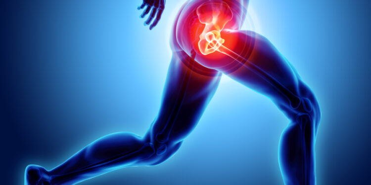 Kada čiurnos sąnario keitimas nėra tinkama procedūra?