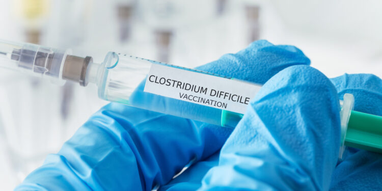 7 būdai, kaip užkirsti kelią C. difficile (Clostridium difficile) plitimui