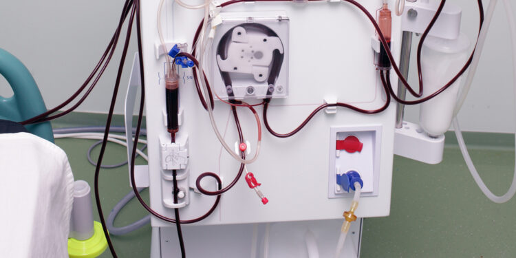 Šlapimo karbamido azoto tyrimas