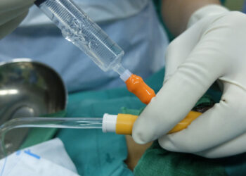 Botulino toksino injekcijos dėl padidėjusio šlapimo pūslės aktyvumo