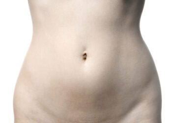 Niežtintis bambos plotas