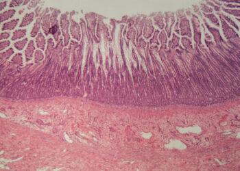 Ar mikroskopinį kolitą sukelia imuninės sistemos reakcija?