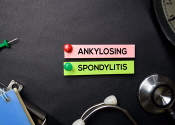 Ankilozinio spondilito progresavimas