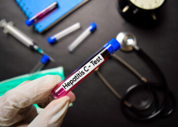 Ar galima užsikrėsti hepatitu C per seiles?