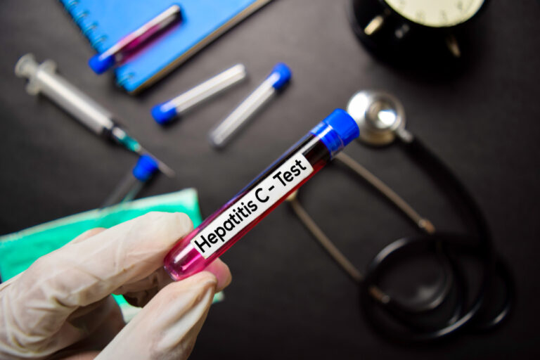 Ar galima užsikrėsti hepatitu C per seiles?