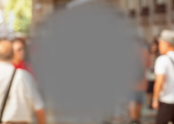 Kas yra fotopsija ir dėl ko ji atsiranda?