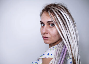 Dermatozė papulosa nigra