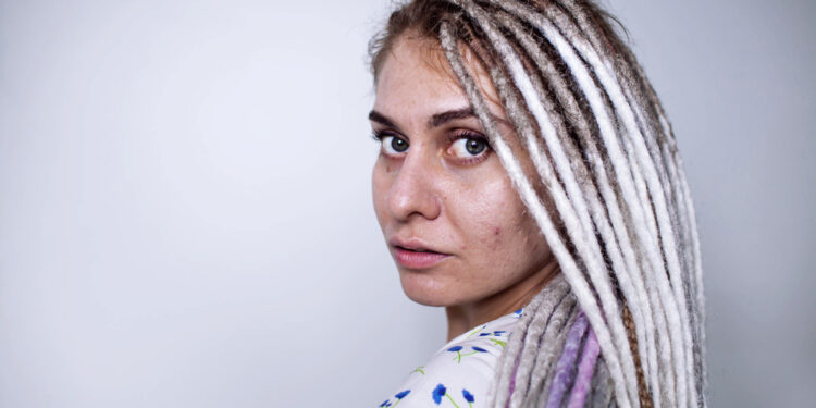 Dermatozė papulosa nigra