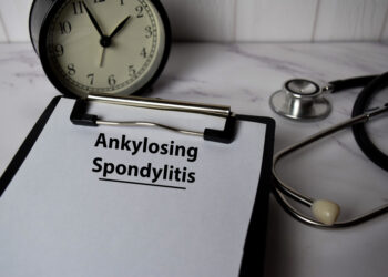 Atsakymų paieškos sergant ankiloziniu spondilitu: Johannos istorija