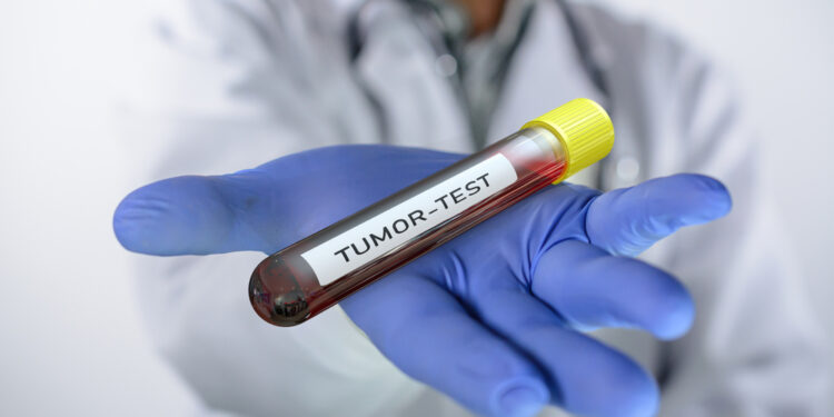 Kas yra naviko žymenys?