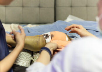 Kaip atpažinti žaliavinį lūžį