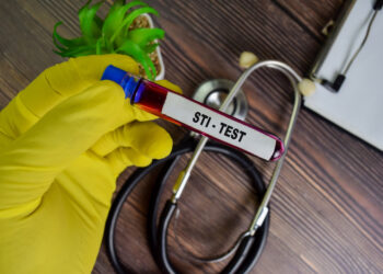 Per kiek laiko pasireiškia LPI simptomai ir kada juos galima nustatyti tyrimuose?