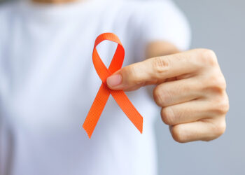 Kaip gyventi su LOPL ir įkvėpti pokyčių