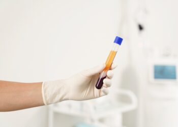 Kaip paruošiama trombocitais praturtinta plazma?