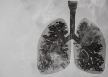 Koks ryšys tarp Pancoast navikų ir Hornerio sindromo?