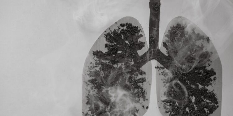 Koks ryšys tarp Pancoast navikų ir Hornerio sindromo?