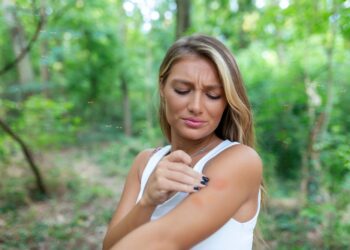 Alergija vabzdžių įkandimams: apžvalga
