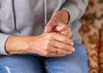 Reumatoidinio artrito valdymo gidas