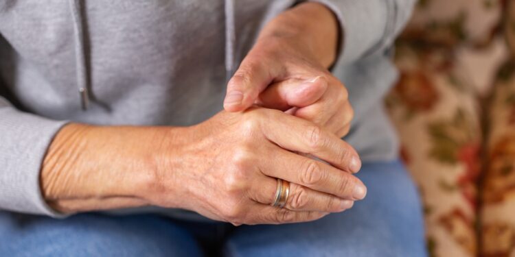 Reumatoidinio artrito valdymo gidas