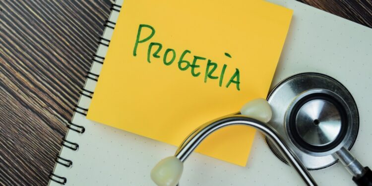 Progerijos sindromas