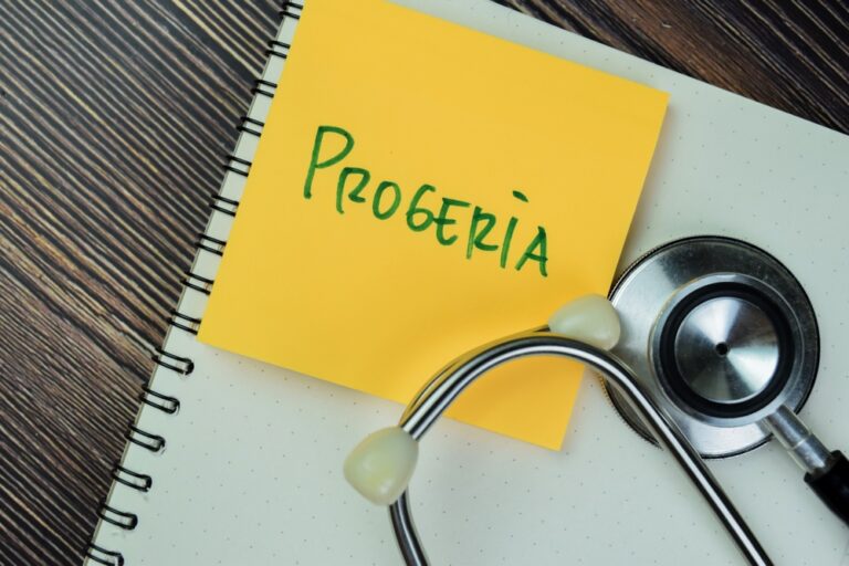 Progerijos sindromas