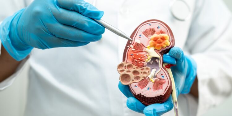 Inkstų ligos požymiai