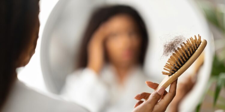 Adderall vartojimo sukeliamas plaukų slinkimas