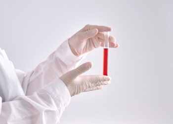 Viskas, ką reikia žinoti apie hemoglobino A1c tyrimą