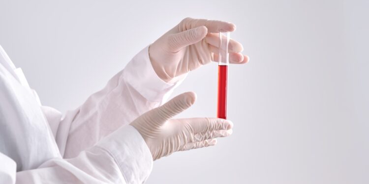 Viskas, ką reikia žinoti apie hemoglobino A1c tyrimą