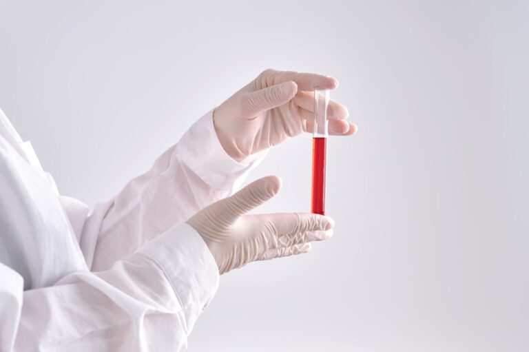 Viskas, ką reikia žinoti apie hemoglobino A1c tyrimą