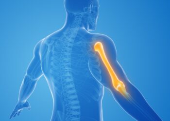 Kokios yra pavojai atidėliojant peties sąnario keitimo operaciją?