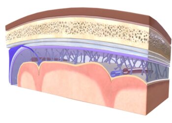 Ekspertas paaiškina 12 meningito serogrupių ir jų reikšmę