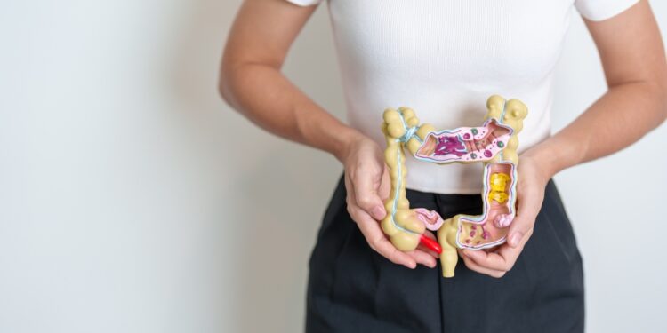 Ar dirgliosios žarnos sindromas (DŽS) sukelia kraują išmatose?