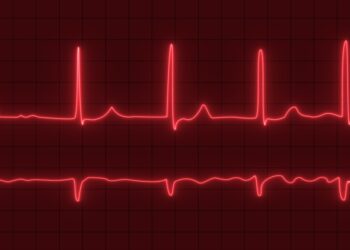 Geriausi būdai valdyti prieširdžių virpėjimo simptomus