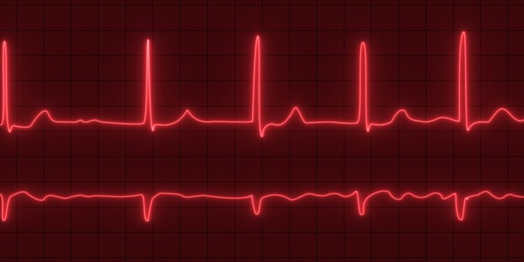 Geriausi būdai valdyti prieširdžių virpėjimo simptomus