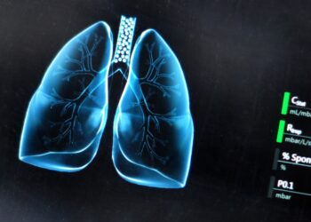 Pirminės plaučių vėžio išplitimo vietos