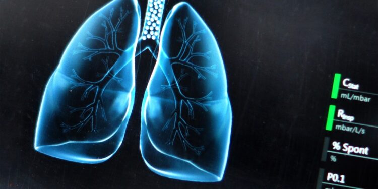 Pirminės plaučių vėžio išplitimo vietos