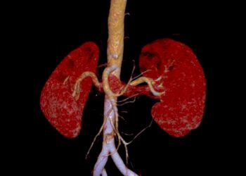 Inkstų kraujagyslės