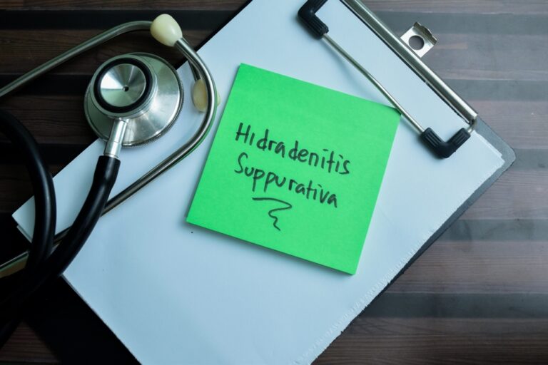 Ar yra ryšys tarp hidradenitinės suppuracijos ir vilkligės?