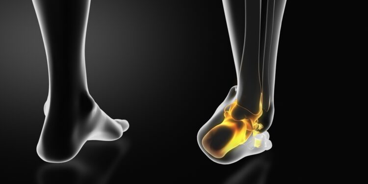 Kurį pasirinkti: čiurnos sąnario suaugdinimą ar keitimą?