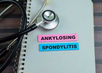 29 dalykai, kuriuos supras tik sergantieji ankiloziniu spondilitu