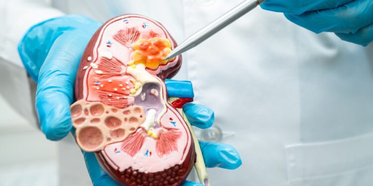 Ar IgA nefropatija paveldima? Genetikos vaidmuo ligos atsiradimui