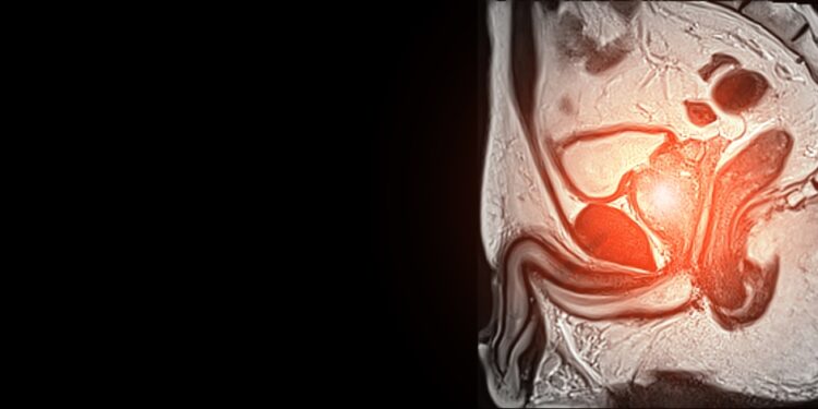 Vyriškoji reprodukcinė sistema