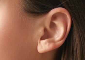 Ką daryti, jei jūsų ausys labiau atsikišusios?